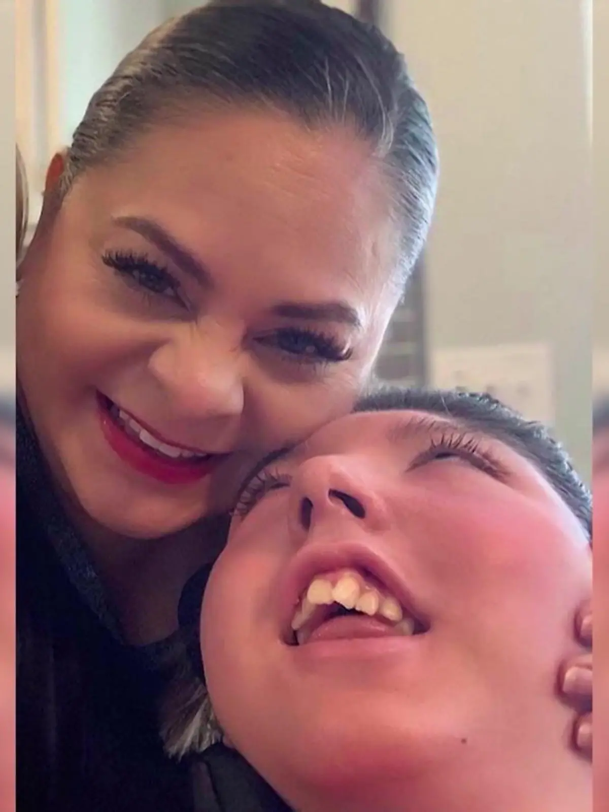 Bild zu: "Medizinisches Wunder! Alex (20) lebt fast ohne Gehirn"