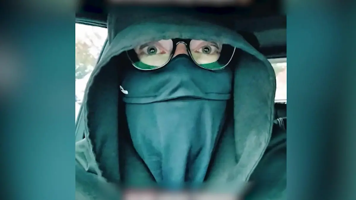 Ein Dasein im Dunkeln! 20 Sekunden Sonne sind für Emily (36) lebensgefährlich Schlimme Sonnenallergie-Symptome