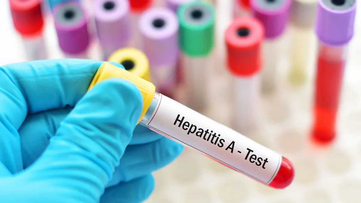 Hepatitis-A-Test (Symbolfoto)