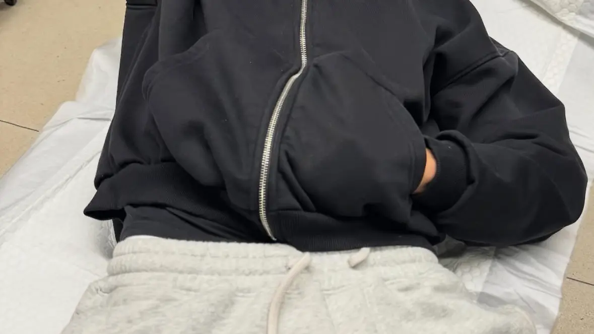 Stefano-Zarella-verbrennt-sich-das-Gesicht