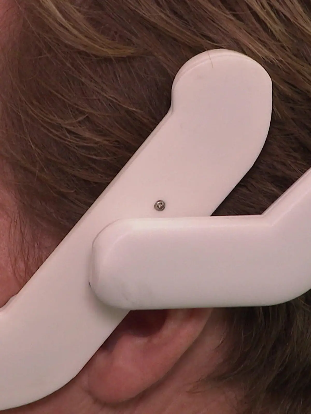 Bild zu: "Dieser Haarreif pusht das Immunsystem"