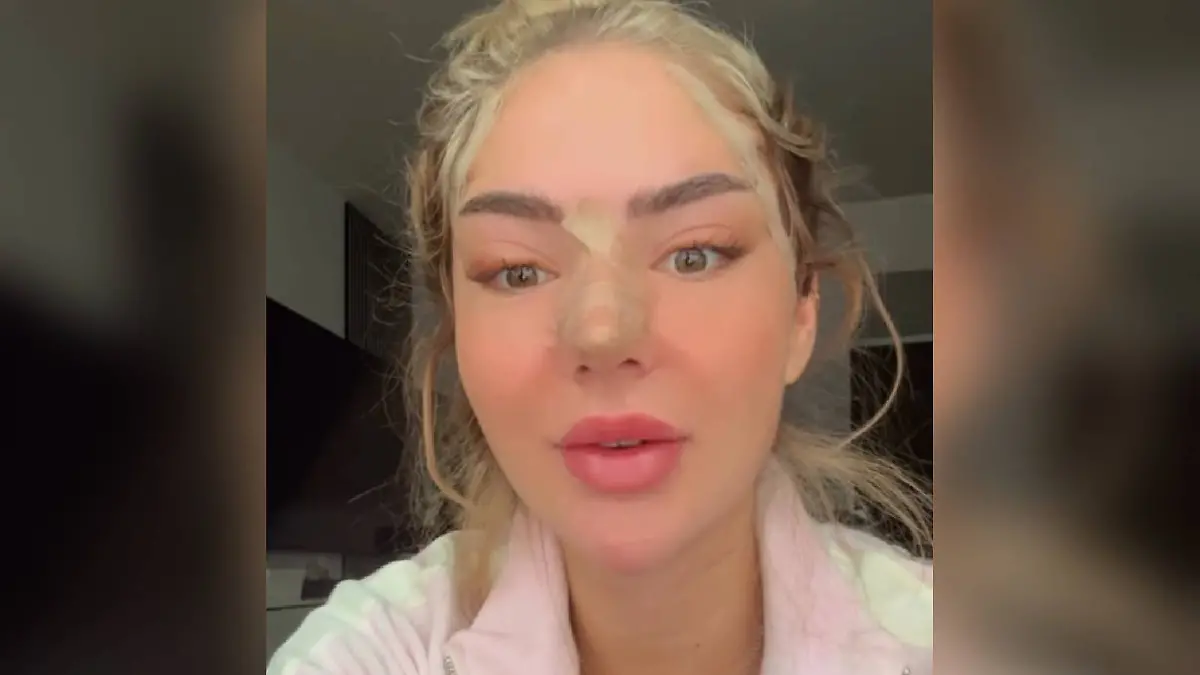 Beauty-OPs bei Emma Fernlund, Leyla Heiter, Paulina Ljubas und Co.: Diese Reality-Stars haben sich krass verändert