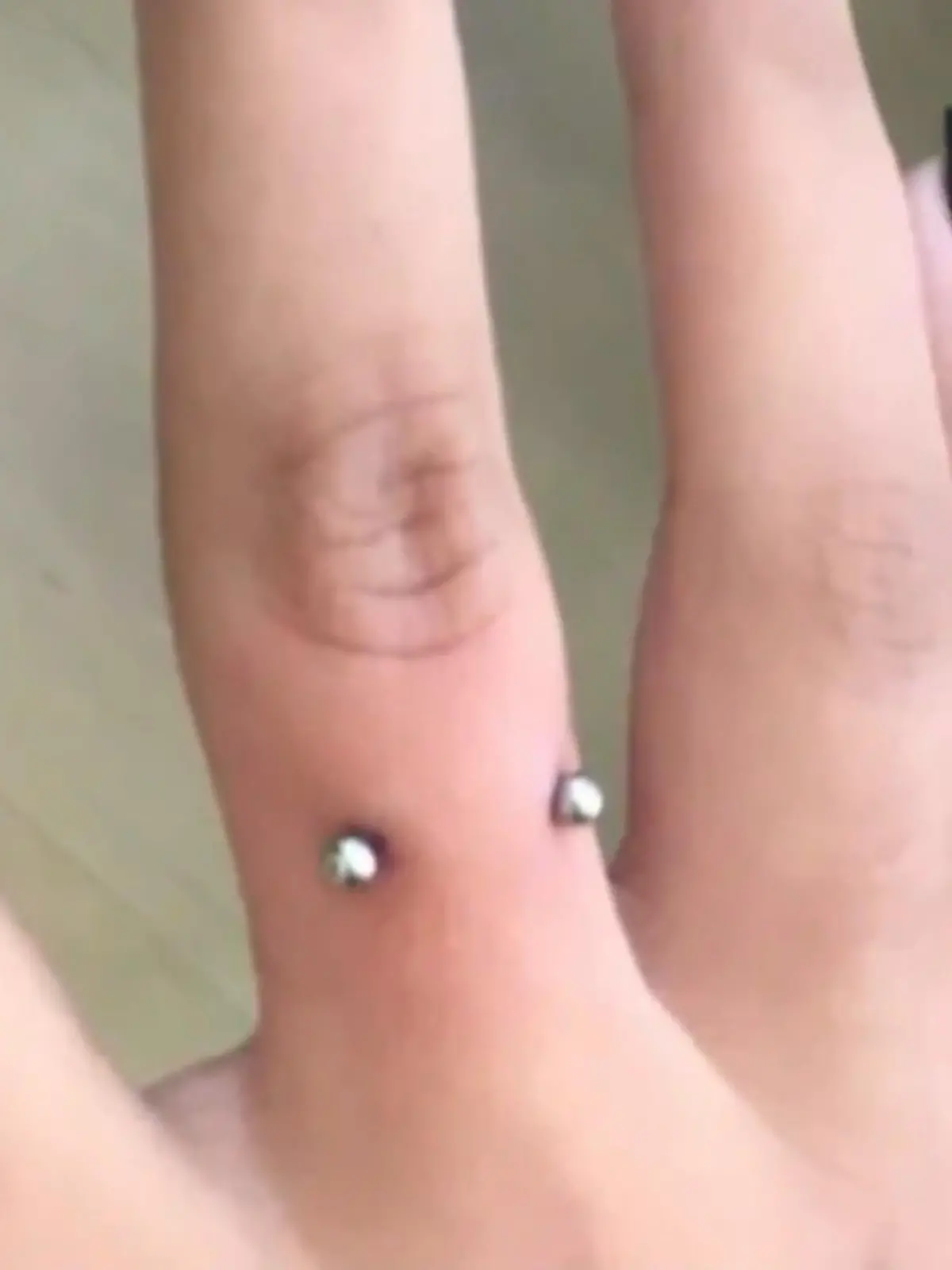 Bild zu: "Fingerpiercing für Minderjährige?"