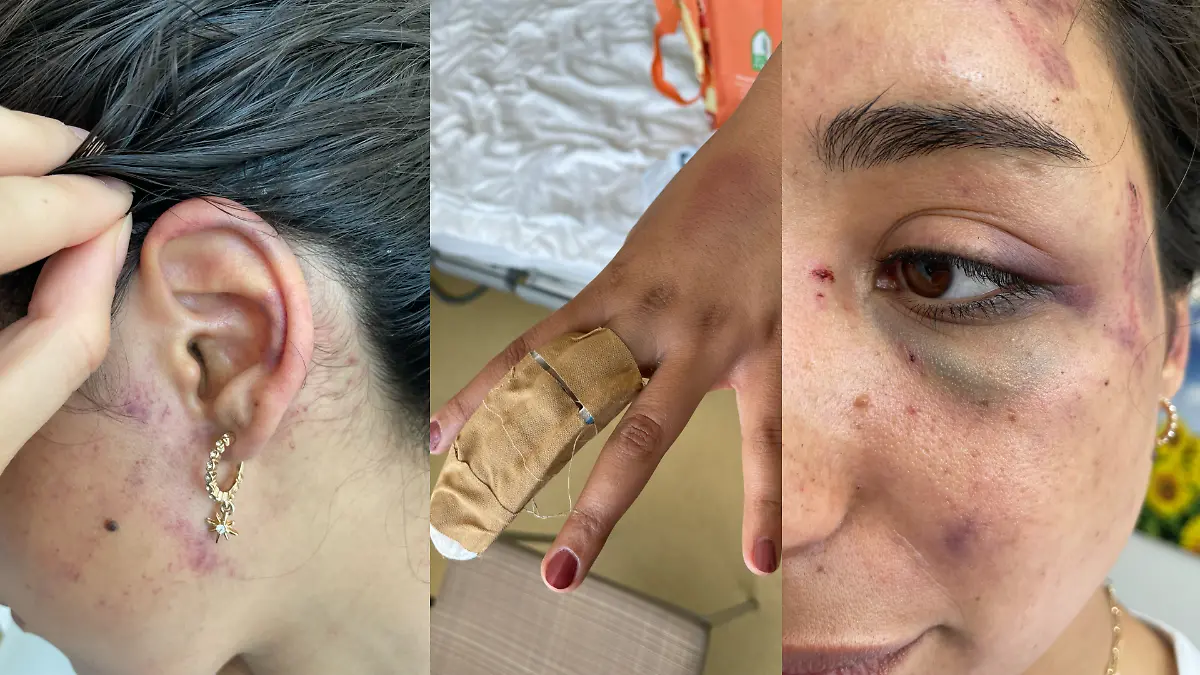 Unter früheren Kollegen hatte Sogol den Ruf tollpatschig zu sein. Niemand schien bei ihren blauen Flecken an die Folge häuslicher Gewalt zu denken. 