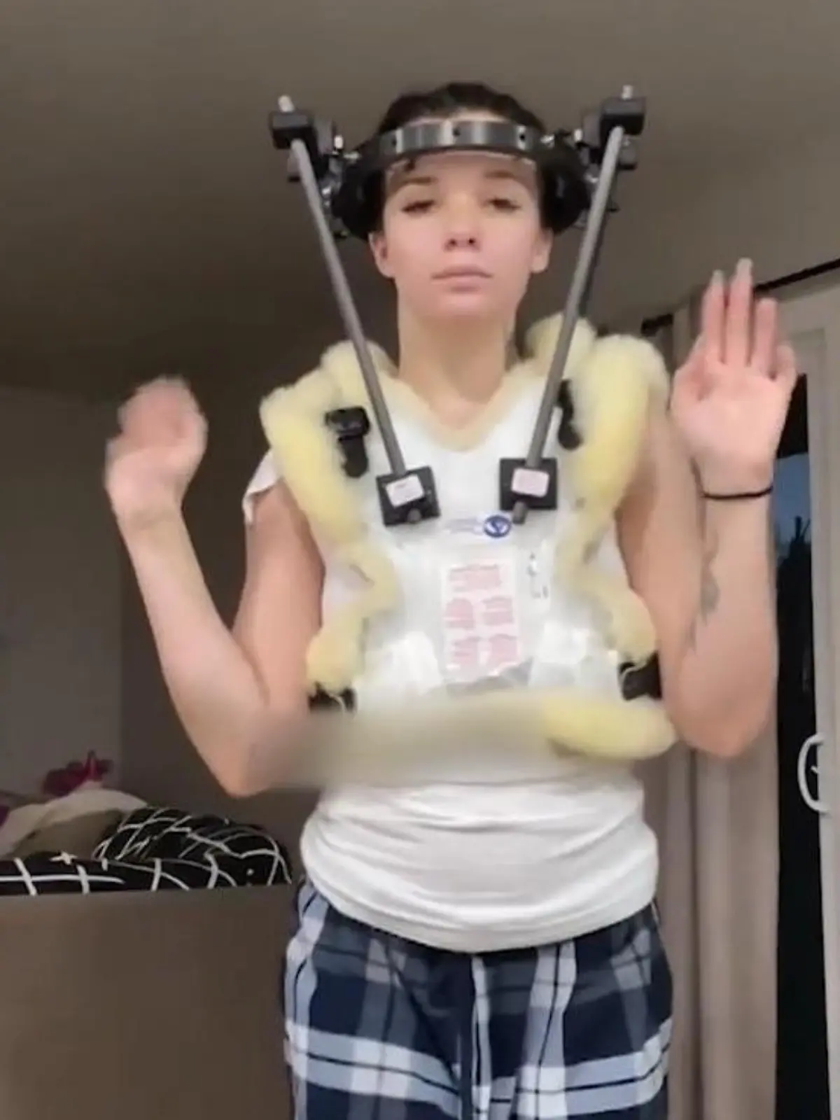 Bild zu: "Nach Horror-Unfall! Jordyn (25) lebt monatelang mit Schrauben im Kopf"