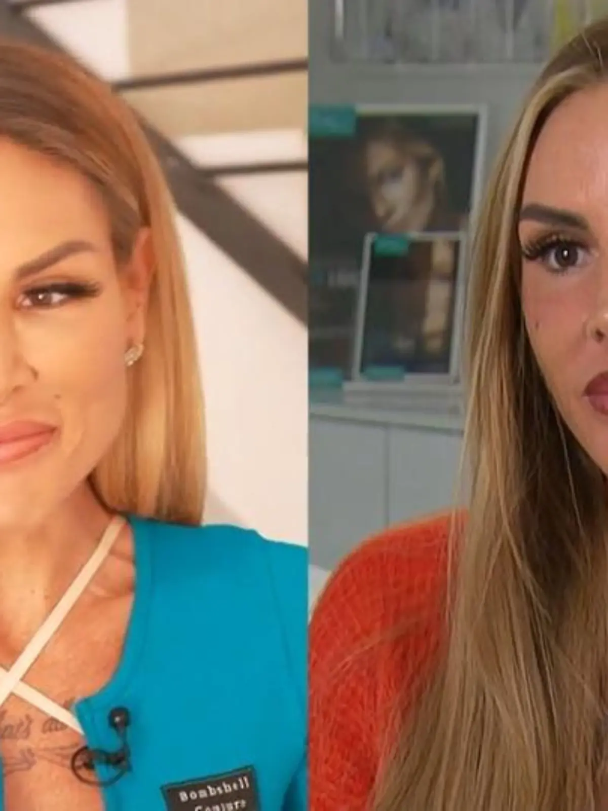 Bild zu: "Lishas schmerzhafter Weg zurück in die Natürlichkeit"