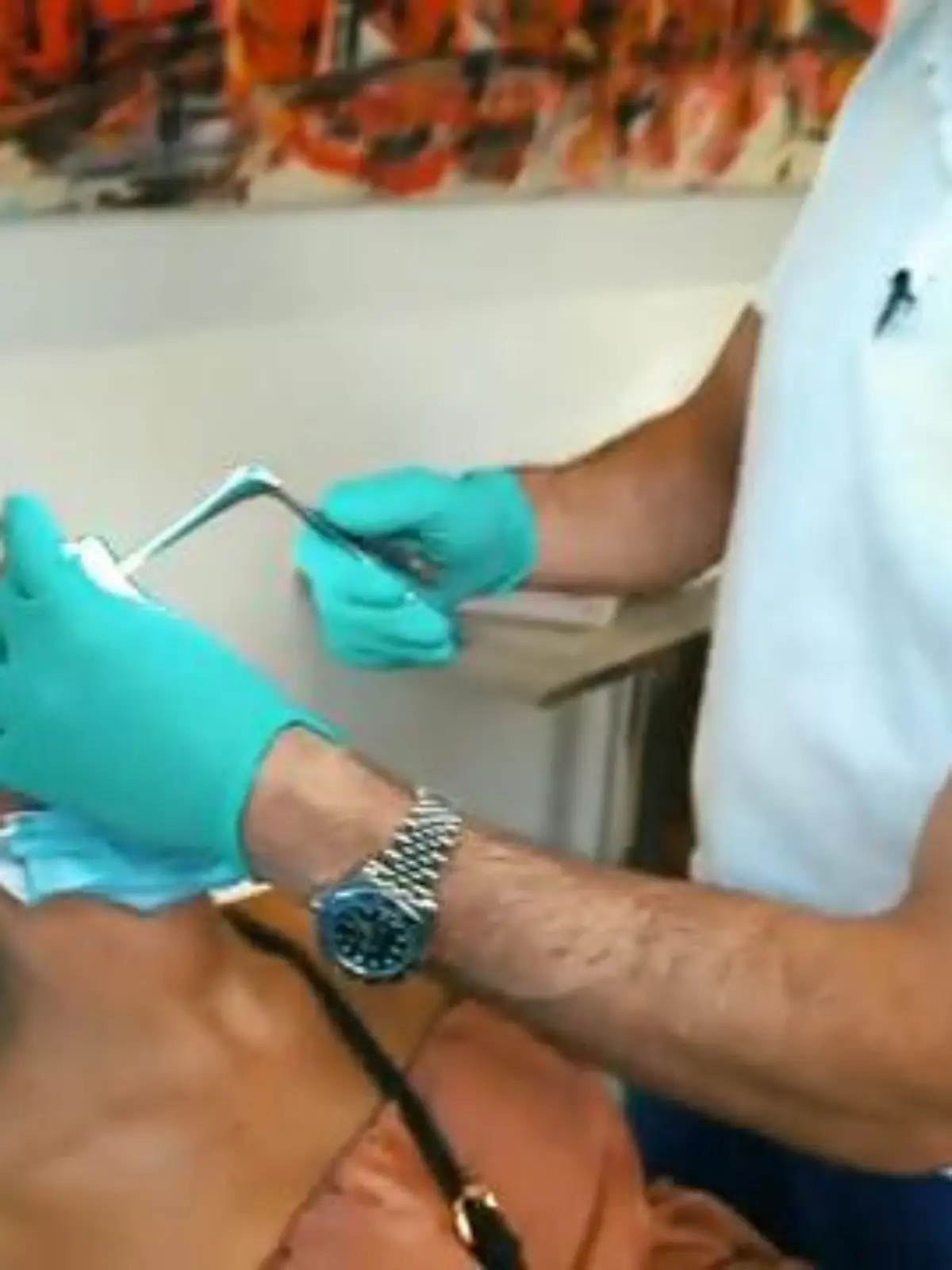 In Teil 3 der Wochenserie will Dr. Sinis der jungen Mutter Angela helfen. Nach einer verpfuschten OP kann sie kaum atmen, doch ihr Anliegen ist ein schwerer Fall für den erfahrenen Chirurgen.