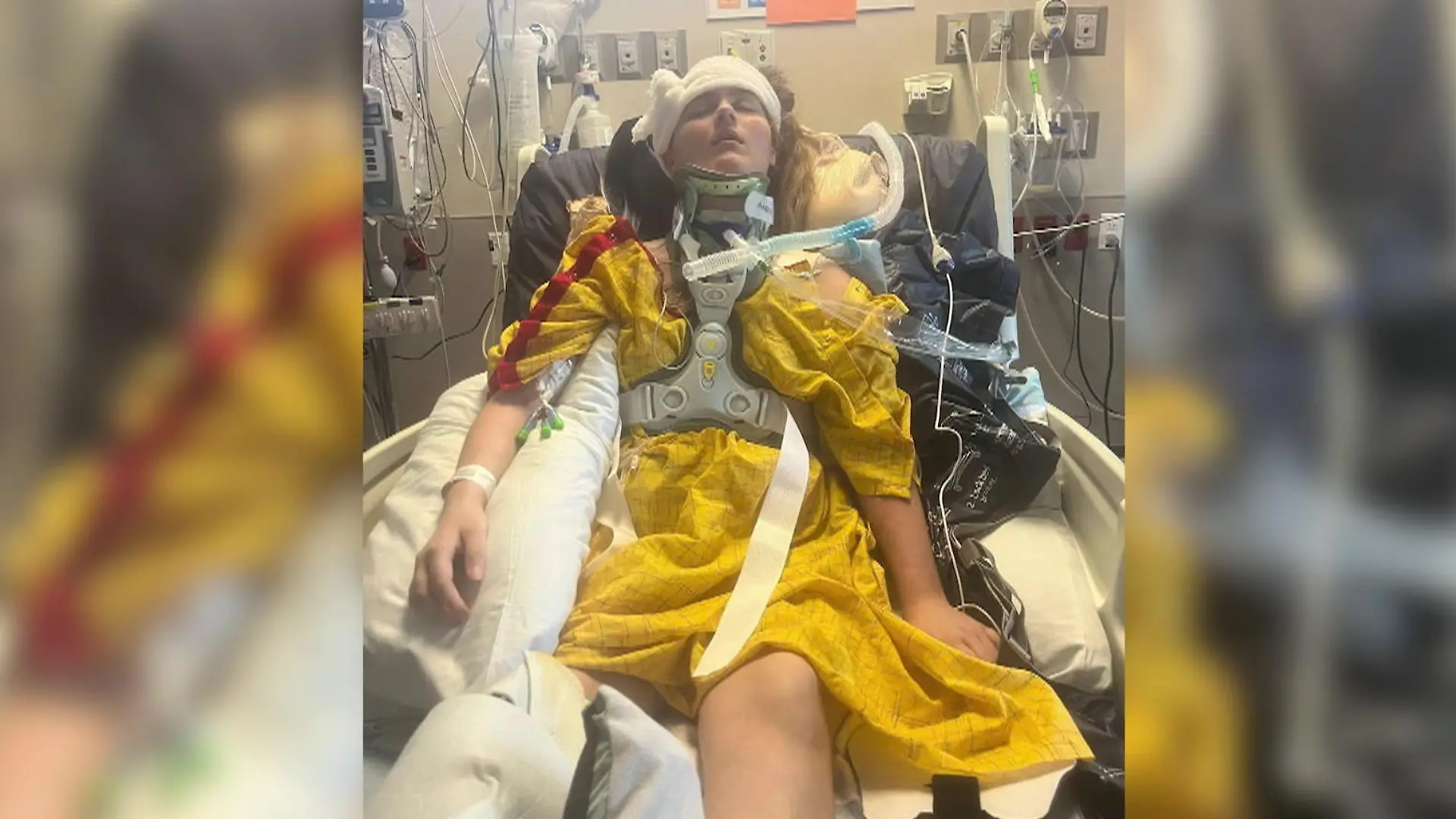Influencerin (22) bei Horror-Unfall „innerlich enthauptet" – doch sie lebt! Betrunkene Fahrerin flüchtet
