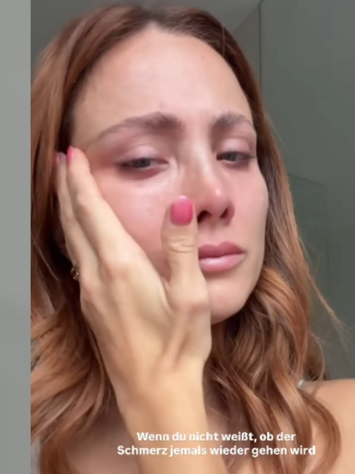 Bild zu: "Gürtelrose-Schock für Influencerin Carmushka"