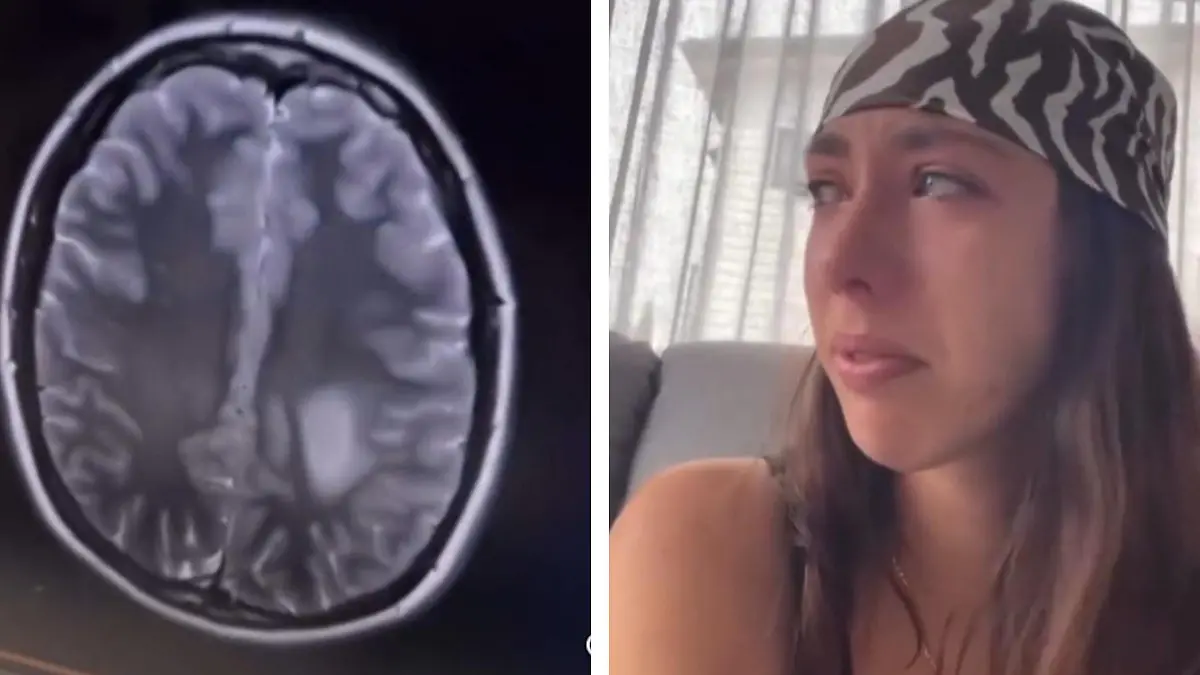 Ärzte haben keine Erklärung! Paige (27) hat tödlichen Hirntumor – und plötzlich ist er weg „Ich bin eine medizinische Anomalie”