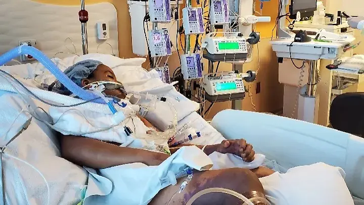 Wegen-Grippe-Kaden-7-aus-Michigan-m-ssen-beide-Beine-amputiert-werden