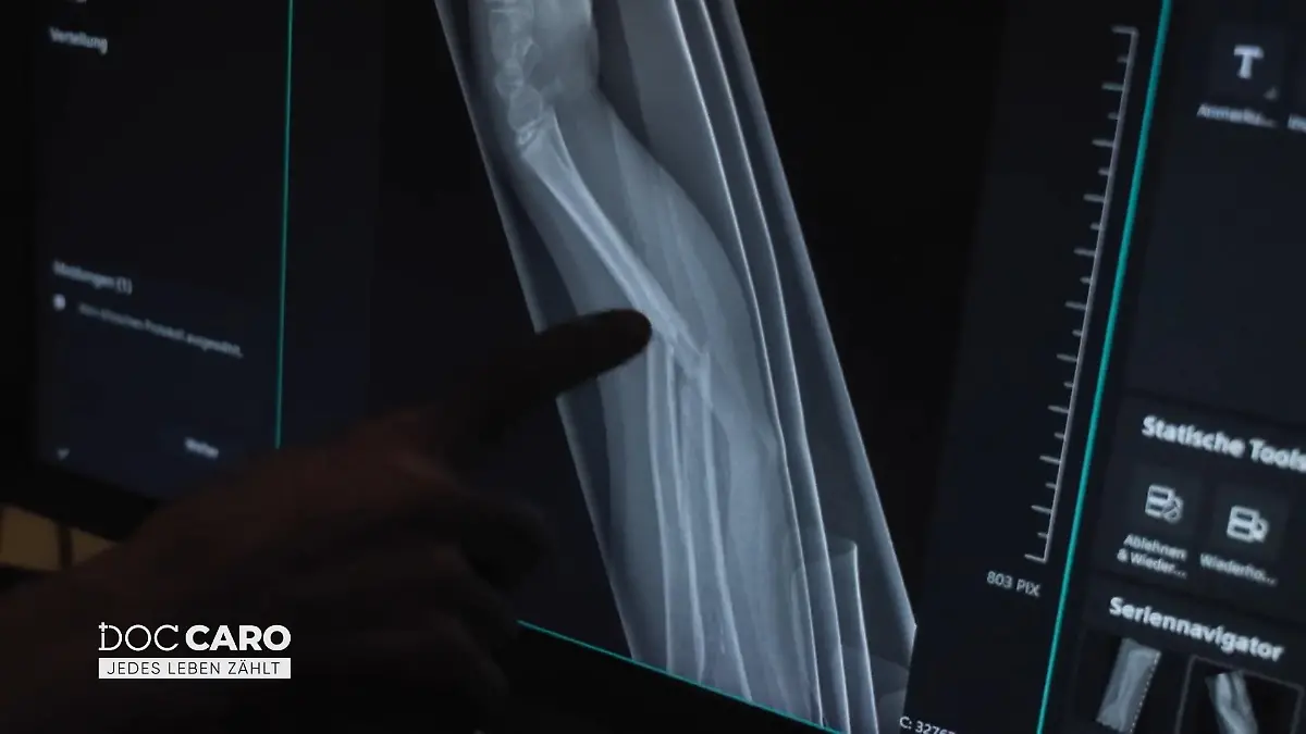 Die junge Patientin muss operiert werden Unterarmbuch