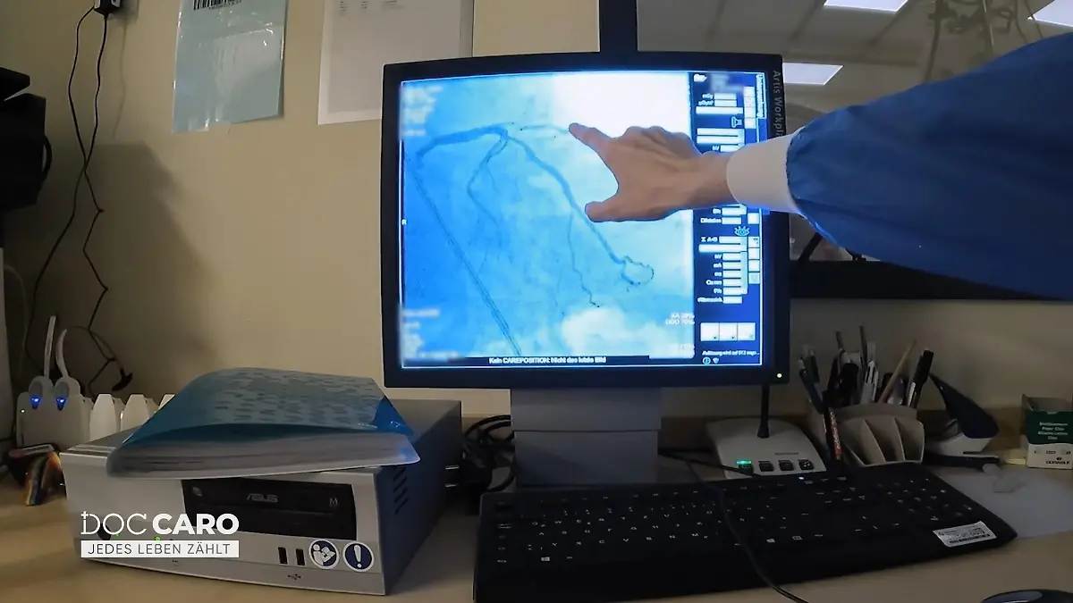 Eine Herzkranzarterie ist komplett verschlossen Untersuchung zeigt