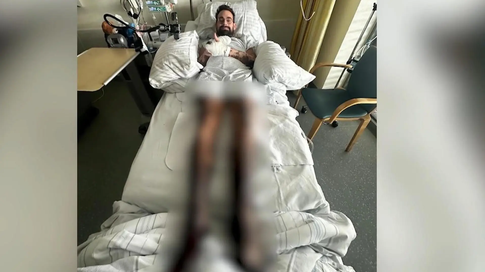 Alessandro verliert beide Beine nach Meningokokken-Infektion Vier Monate kämpft er ums überleben