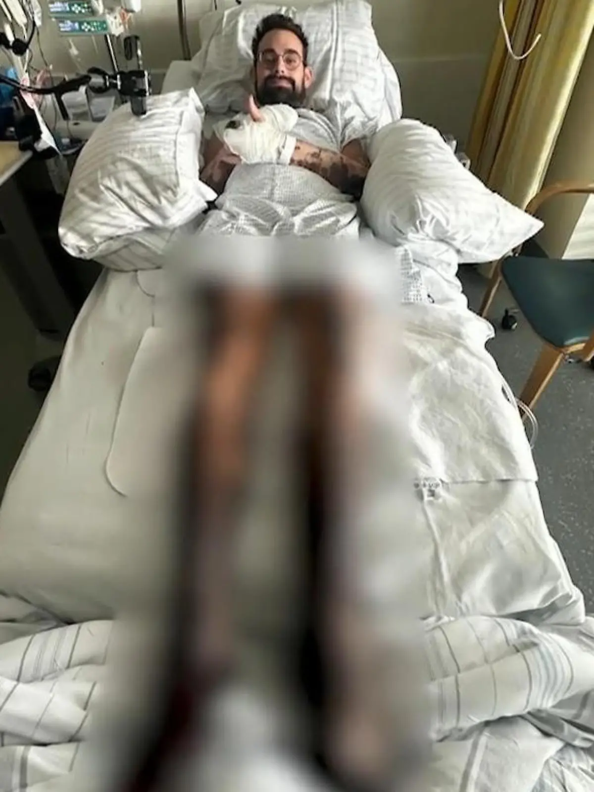 Alessandro liegt in einem Krankenhaus Bett. Die beine sind von seiner Meningokokken-Infektion schon ganz schwarz.