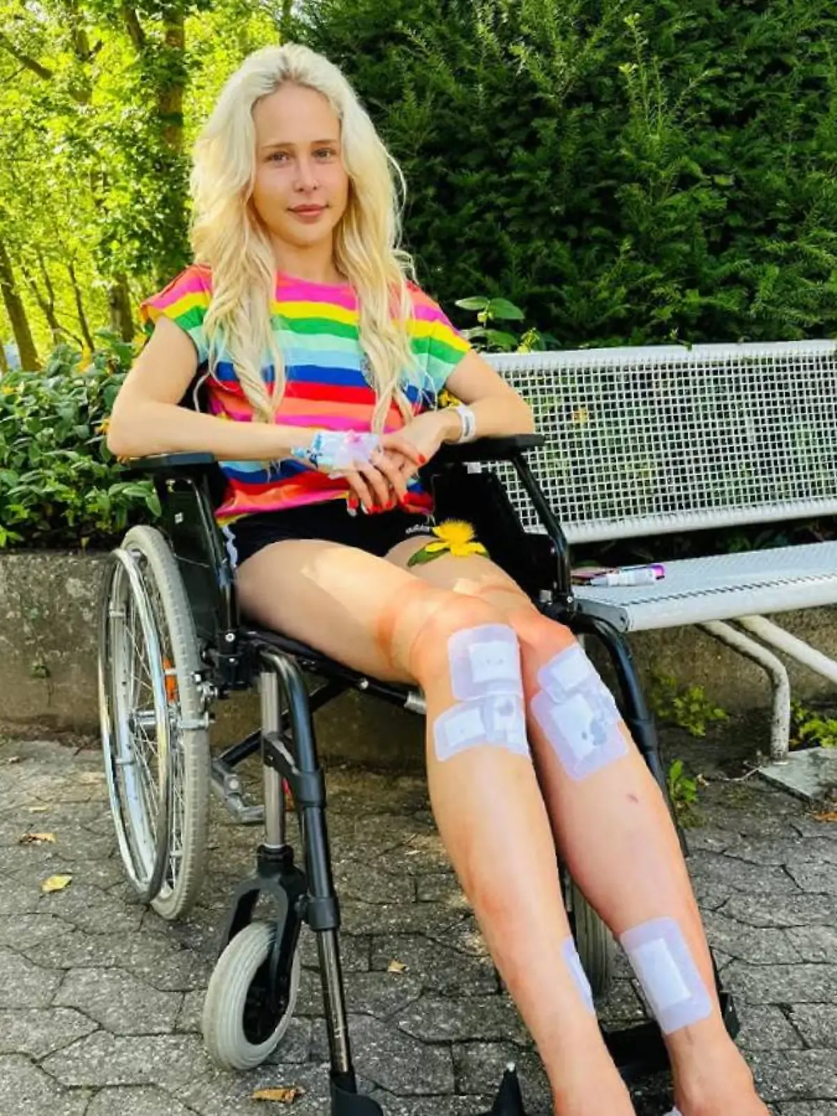 Theresia Fischer nach ihrer letzten Bein-OP. 