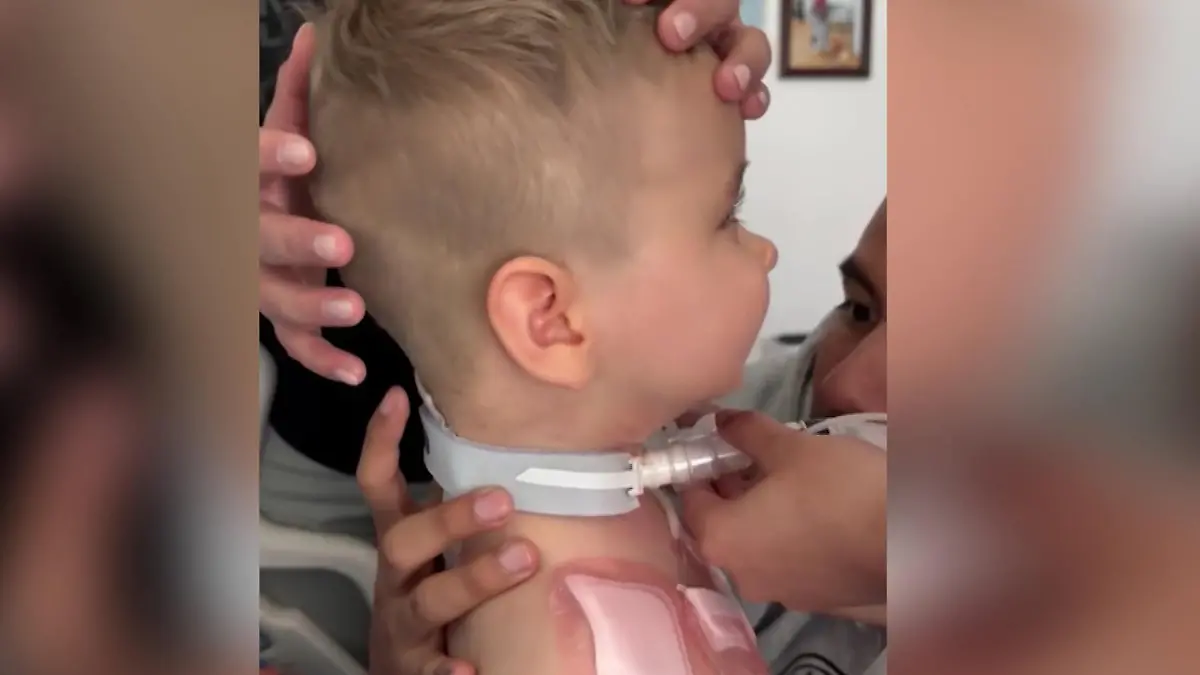 Endlich ohne Halskrause! Olli (2) kann Kopf eigenständig halten Familie voller Hoffnung