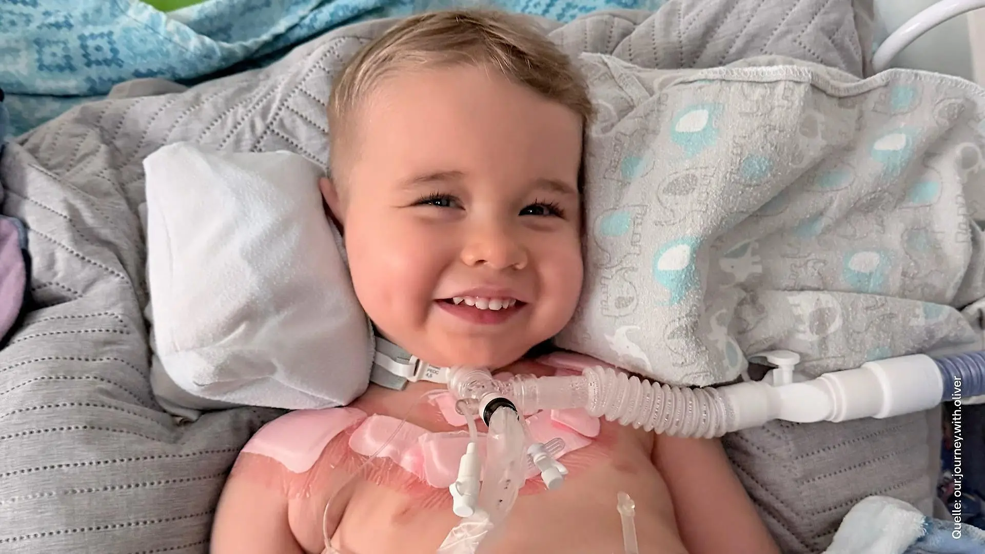 Endlich ohne Halskrause! Olli (2) kann Kopf eigenständig halten Familie voller Hoffnung