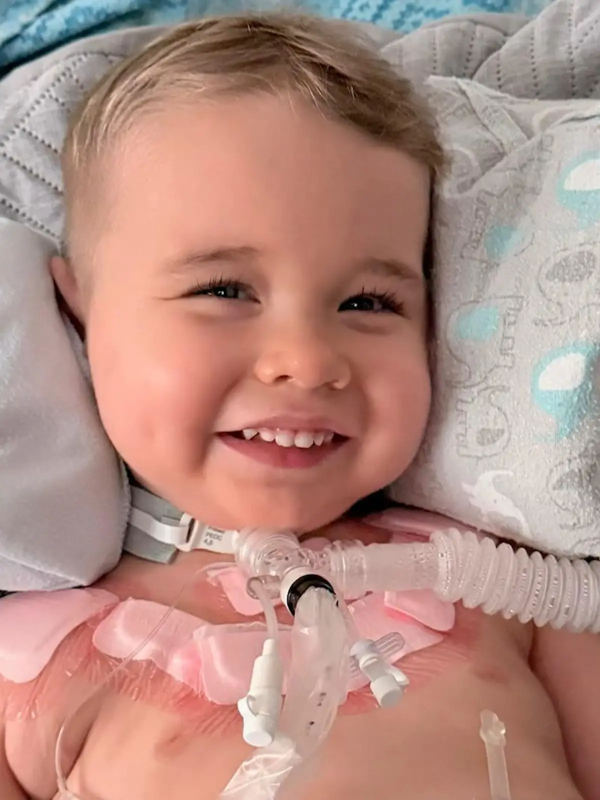 Bild zu: "Endlich ohne Halskrause! Olli (2) kann Kopf eigenständig halten"