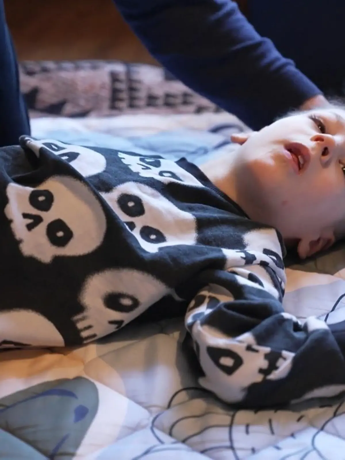 Der kleine Felix kommt mit schweren Hirnschäden zur Welt