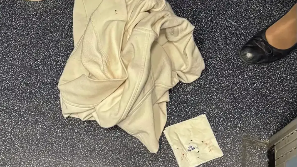 Die Familie wurde wohl auf ihrem Flug von Bettwanzen angegriffen.