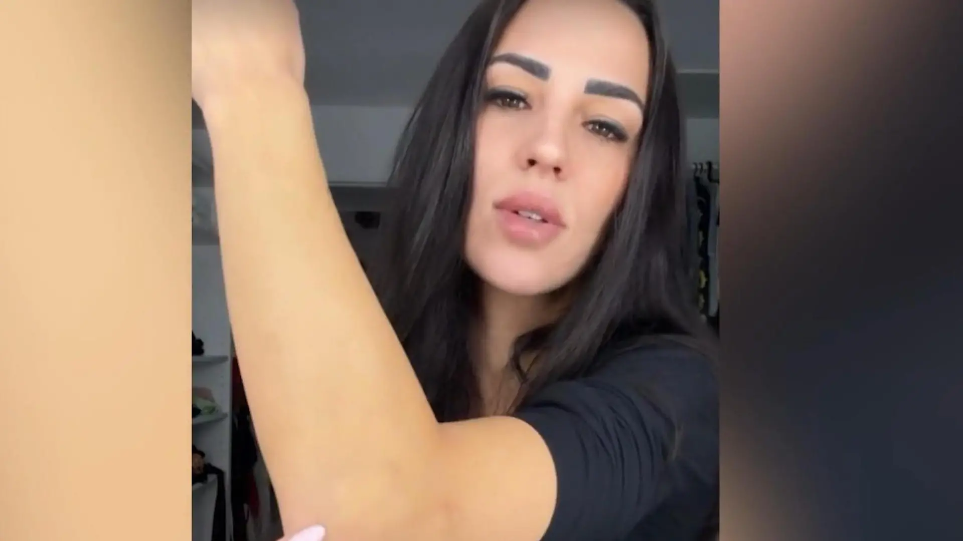 Bild von Elena Miras zeigt Narbe nach schwerem Sturz beim Salsa-Date