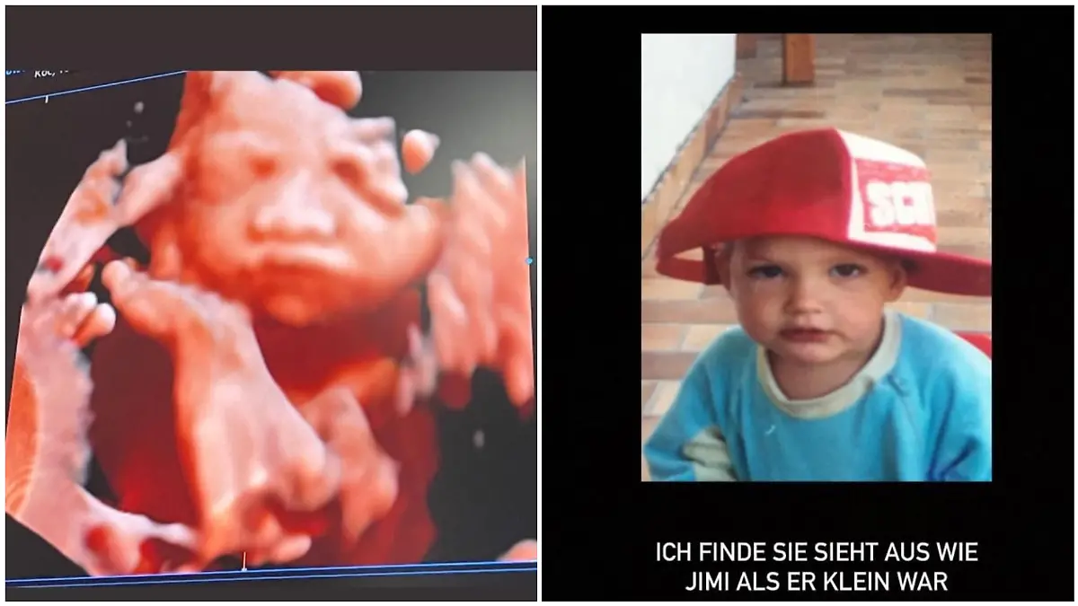 Yeliz Koc zeigt ein Ultraschallbild von ihrer ungeborenen Tochter