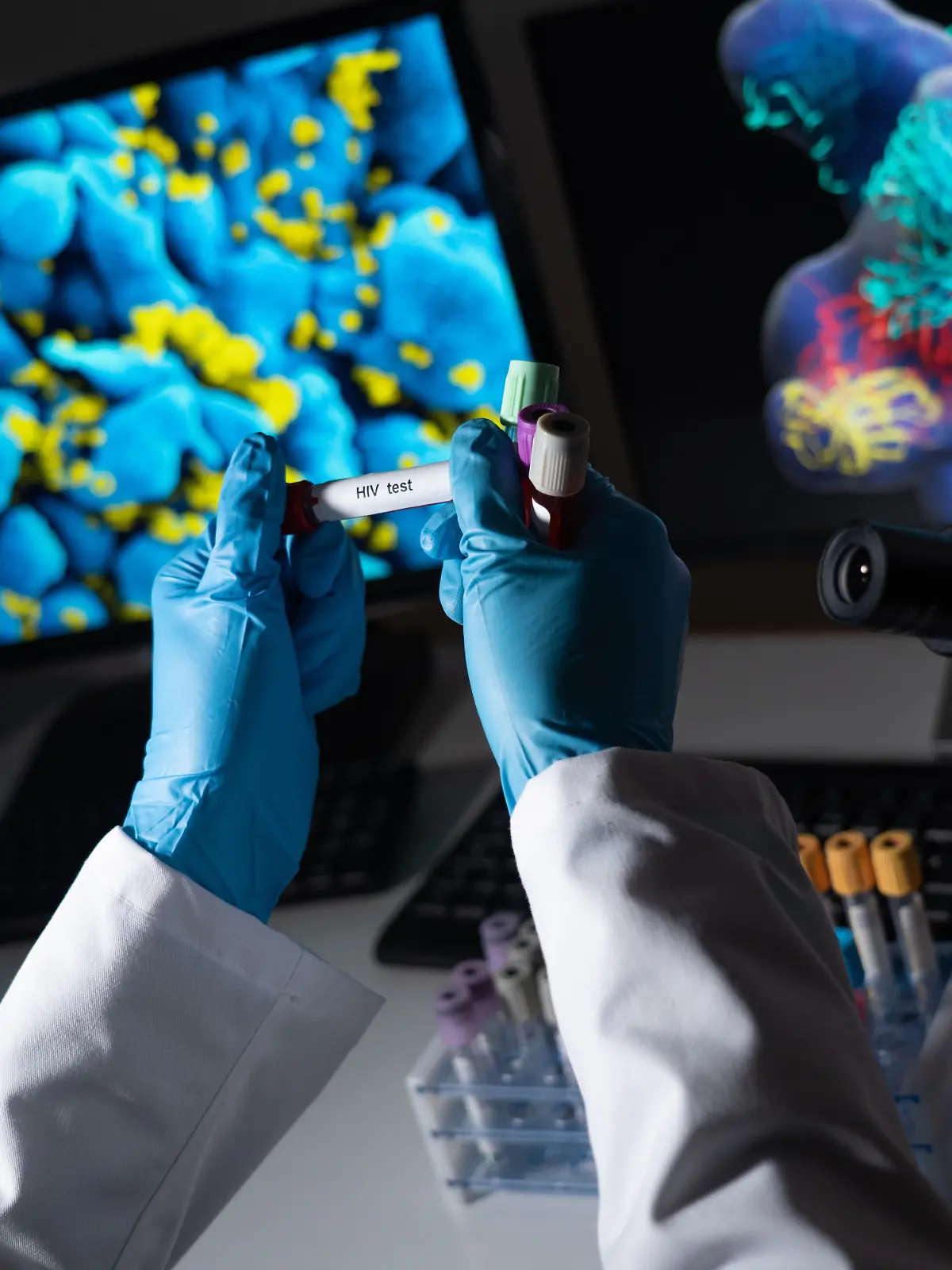 Laboruntersuchung auf STDs: Hepatitis B and C, Syphilis und HIV. (Symbolfoto)