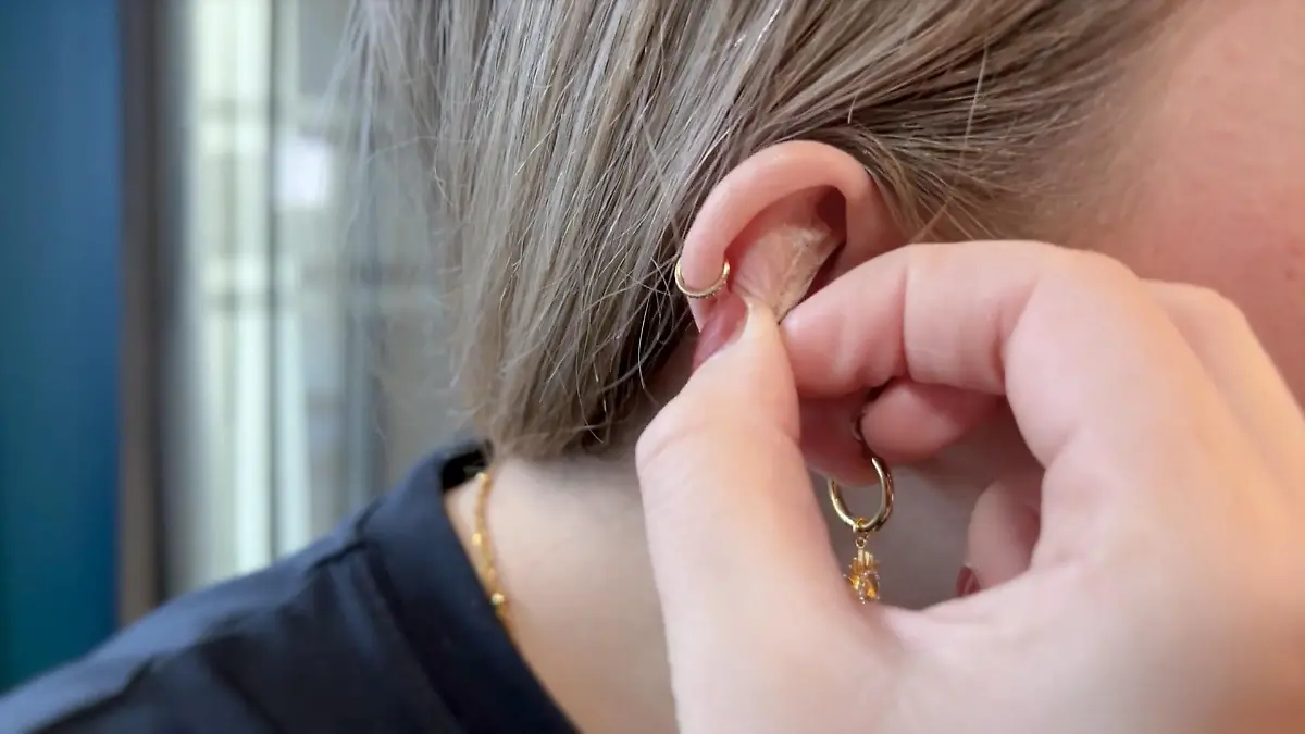 Mega-Trend bei TikTok! Wie Ohr-Akupressur uns wirklich hilft Mini-Trick für mehr Wohlbefinden?