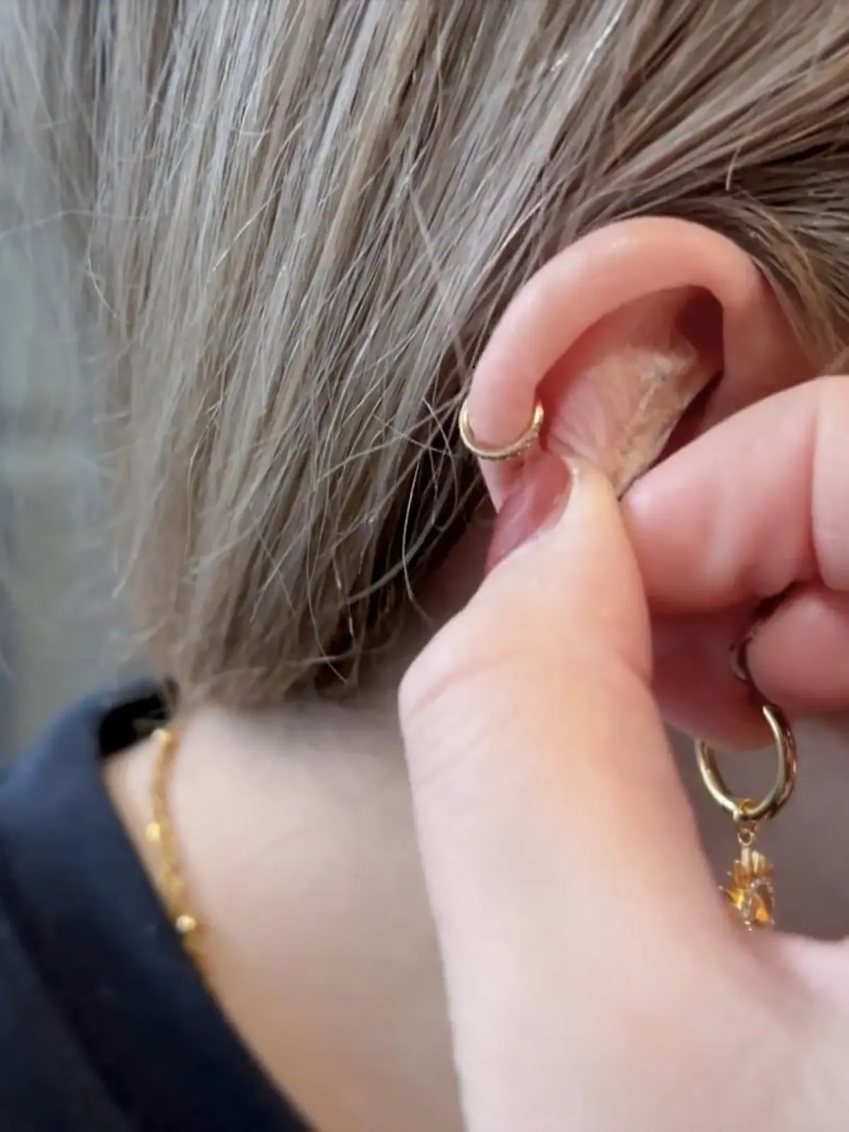 Bild zu: "Mega-Trend bei TikTok! Wie Ohr-Akupressur uns wirklich hilft"