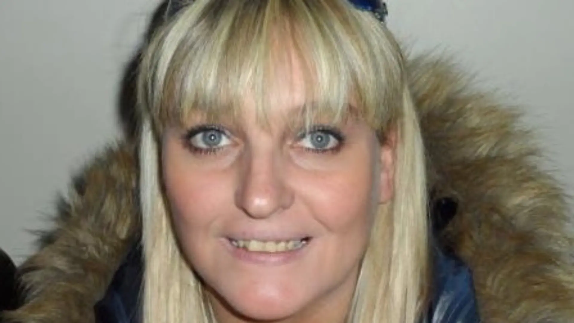 Louise Marshallsay verlor wegen eines Nierensteins Finger und Zehen.