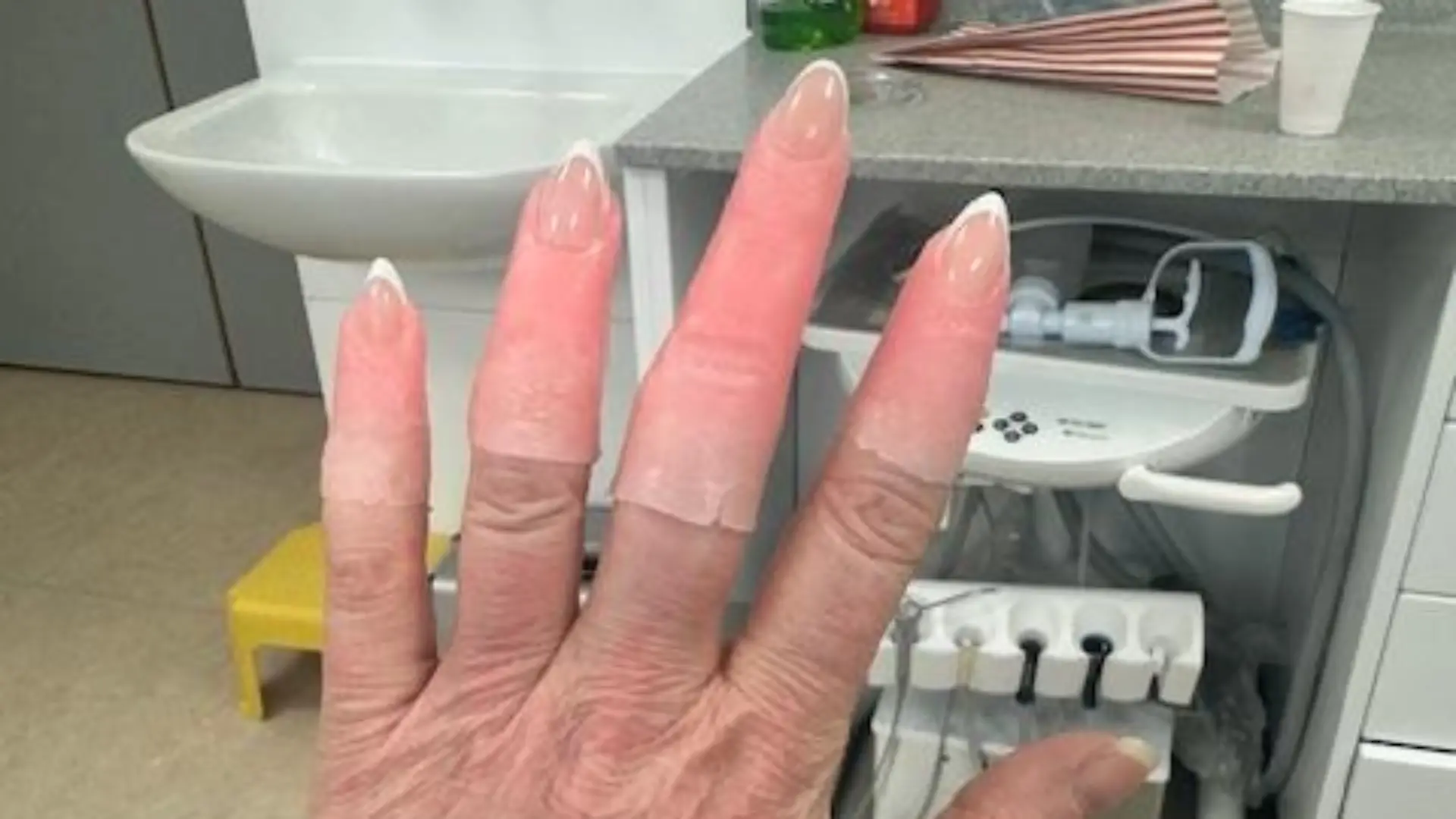 Mittlerweile hat die Mutter dank mehrerer Prothesen ihre Finger und Zehen zurück.