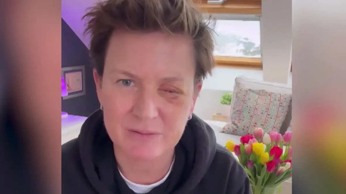 Jetzt fordert sie ein Verbot! Moderatorin (55) erblindet nach Böllerunfall Andrea Plewig verliert linkes Auge