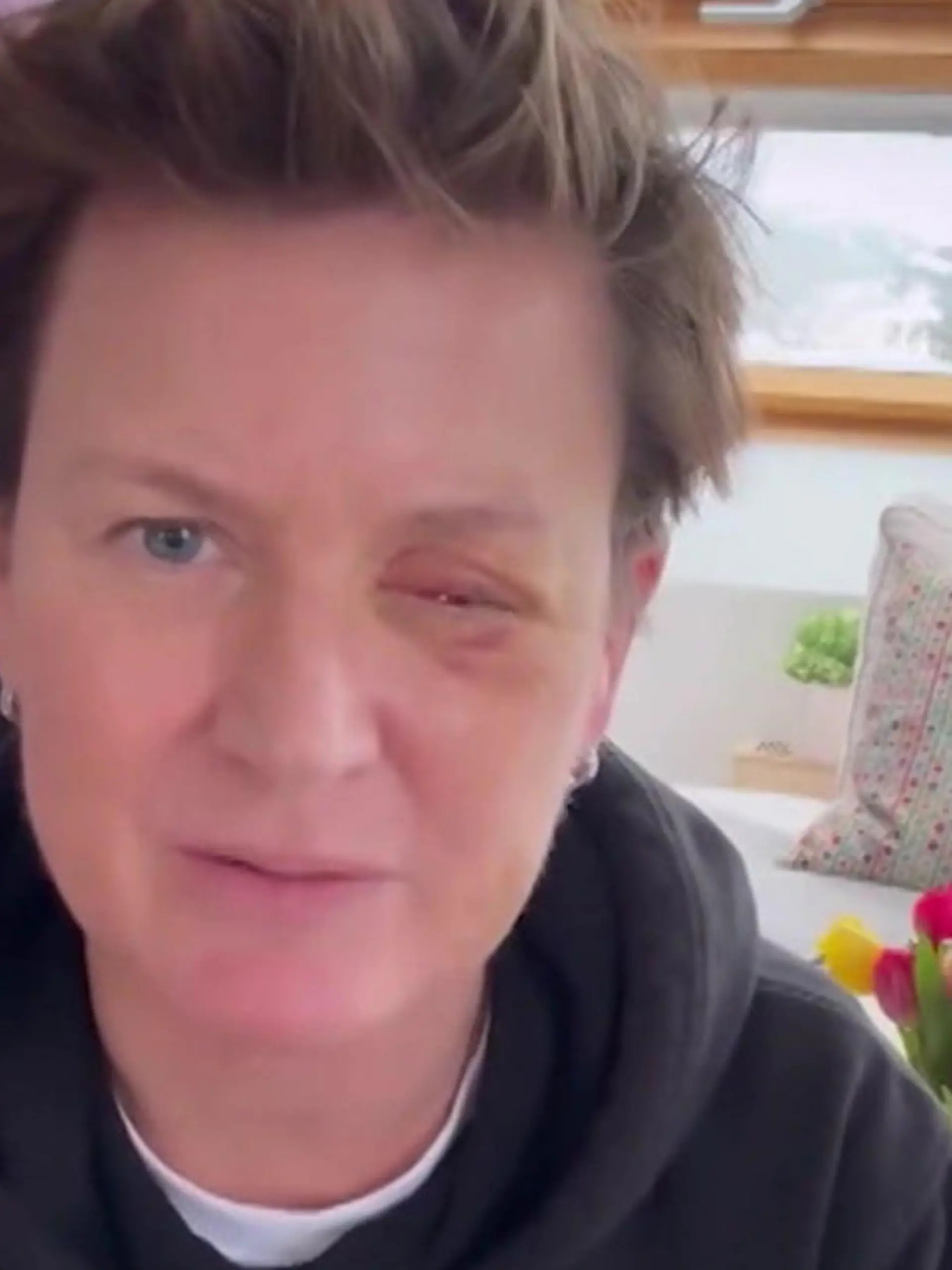 Bild zu: "TV-Moderatorin Andrea Plewig verliert ihr Auge – und fordert DIESES Verbot"