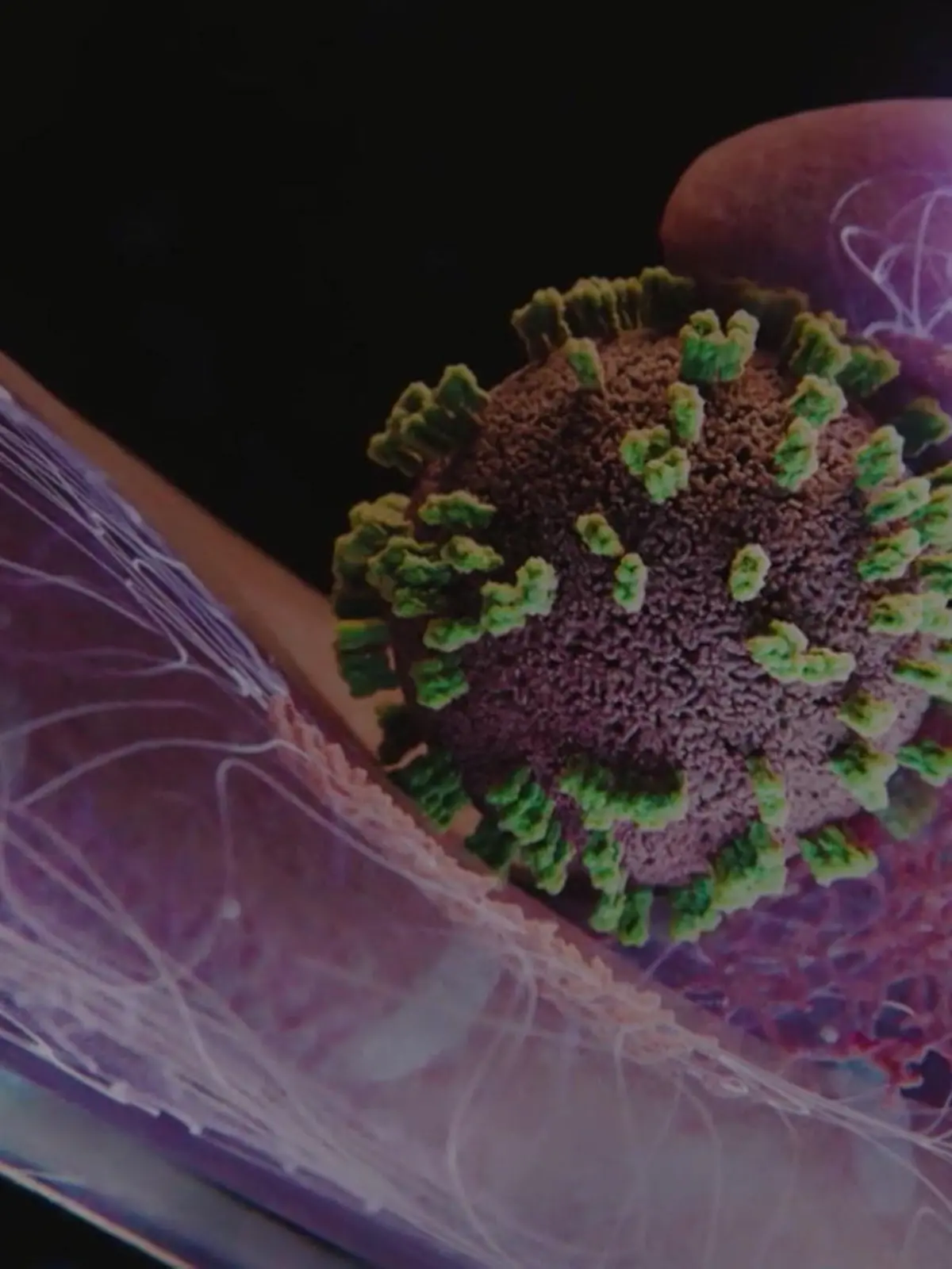 Bild zu: "Super-Grippe breitet sich in Deutschland aus"