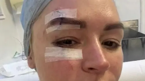 Britische-Star-Moderatorin-Laura-Woods-38-zeigt-Horror-Verletzung-im-Gesicht