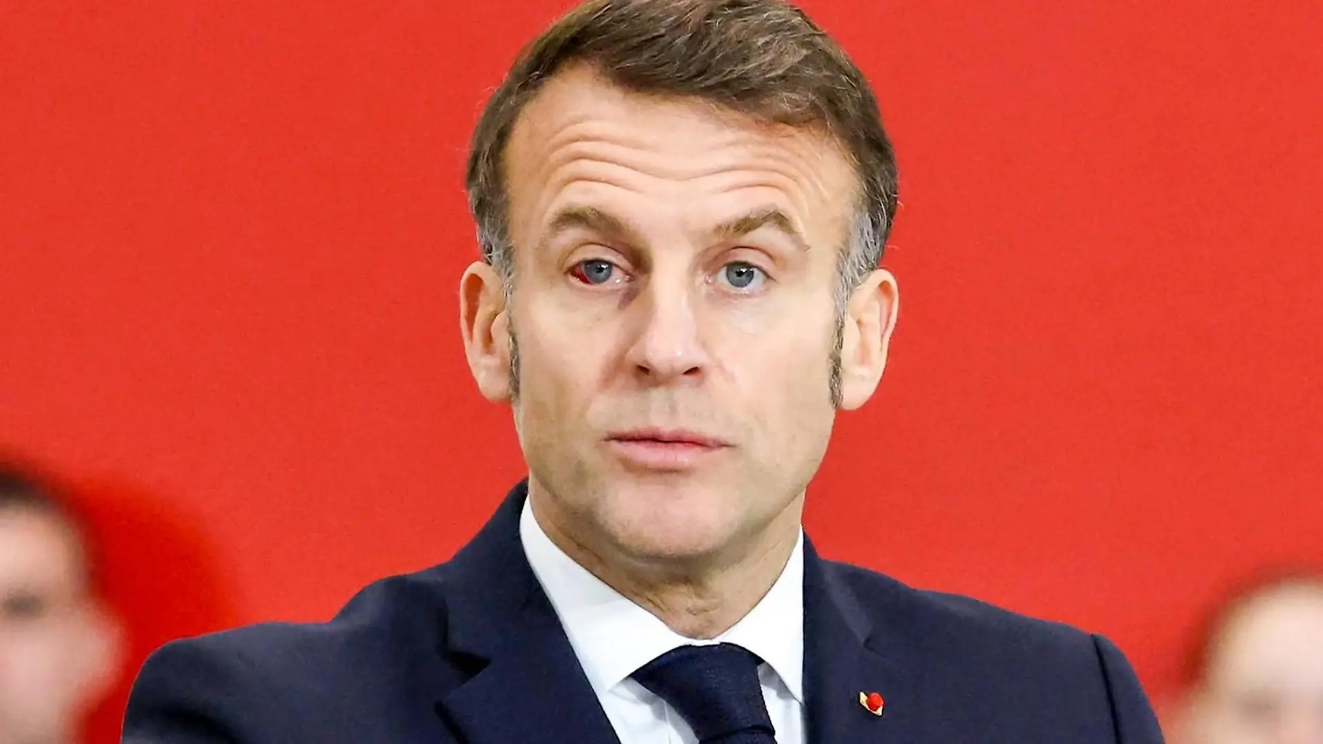 Frankreichs Präsident schockt bei Rede mit Verletzung Emmanuel Macron mit blauem Auge
