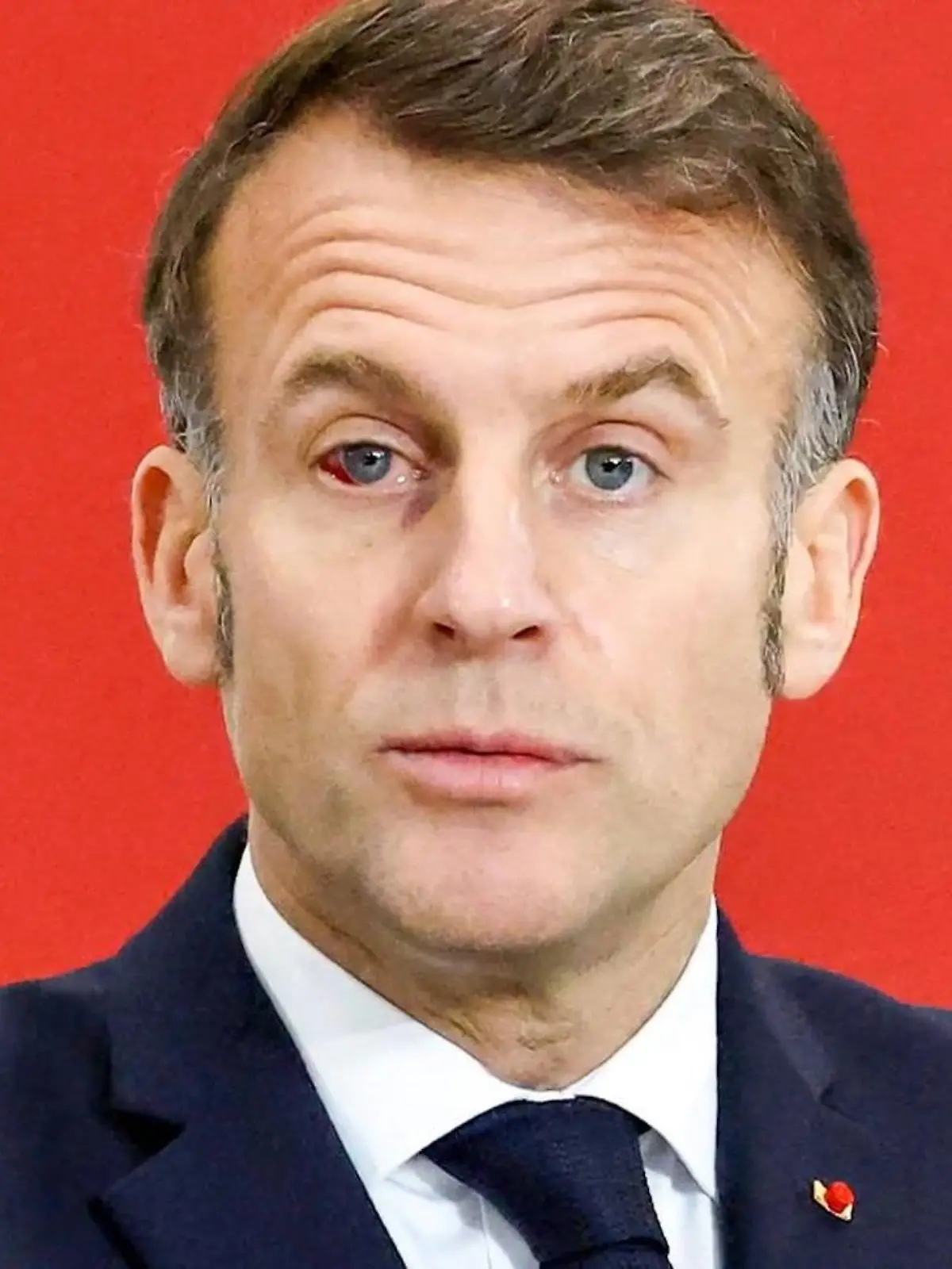 Bild zu: "Wie sieht der denn aus? Frankreichs Präsident schockt bei Rede mit Verletzung"