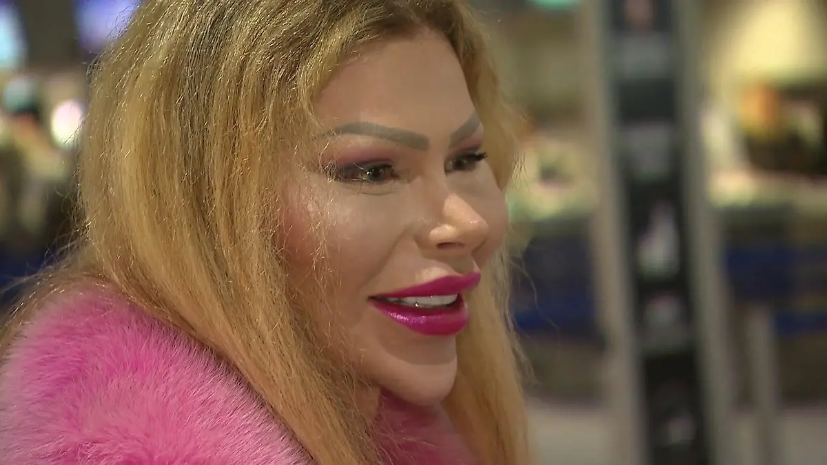 Dschungelcamp-2026-SO-sah-Hubert-Fellas-Begleitung-Patrick-Kroner-vor-den-Beauty-OPs-aus-