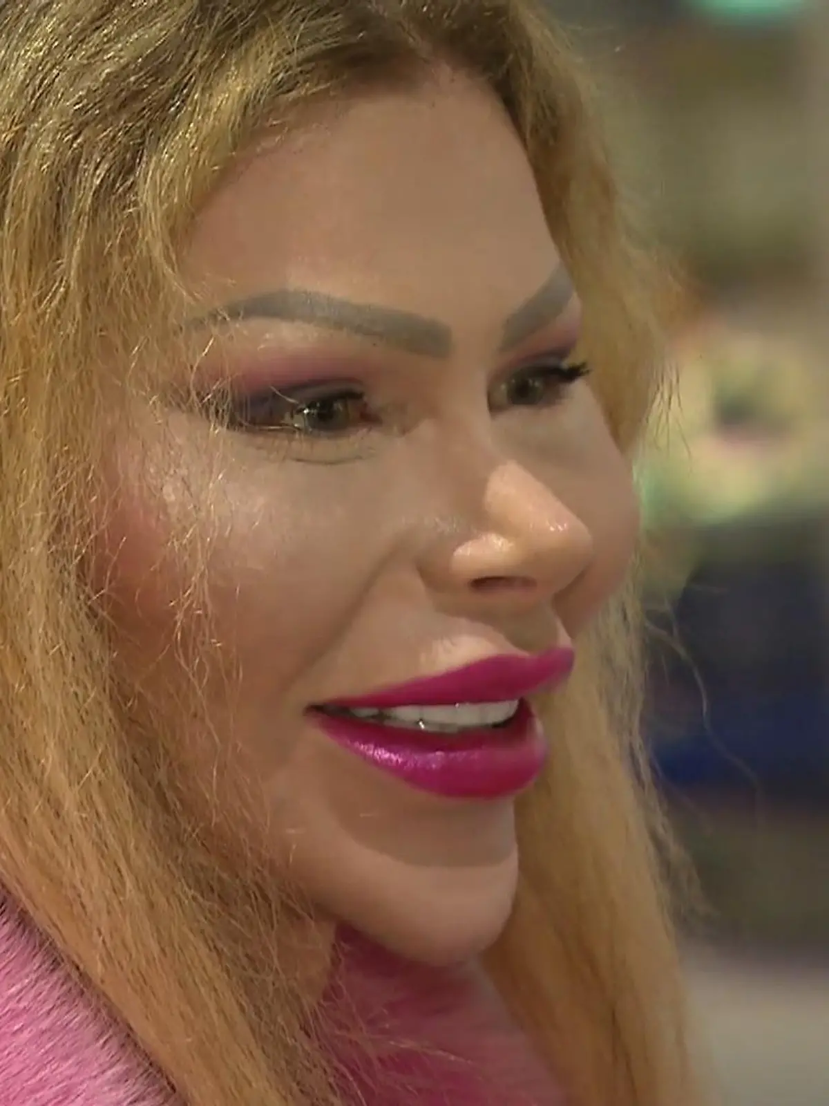 Bild zu: "Erster Eingriff mit 18! SO sah Hubert Fellas Dschungelcamp-Begleitung vor den Beauty-OPs aus"