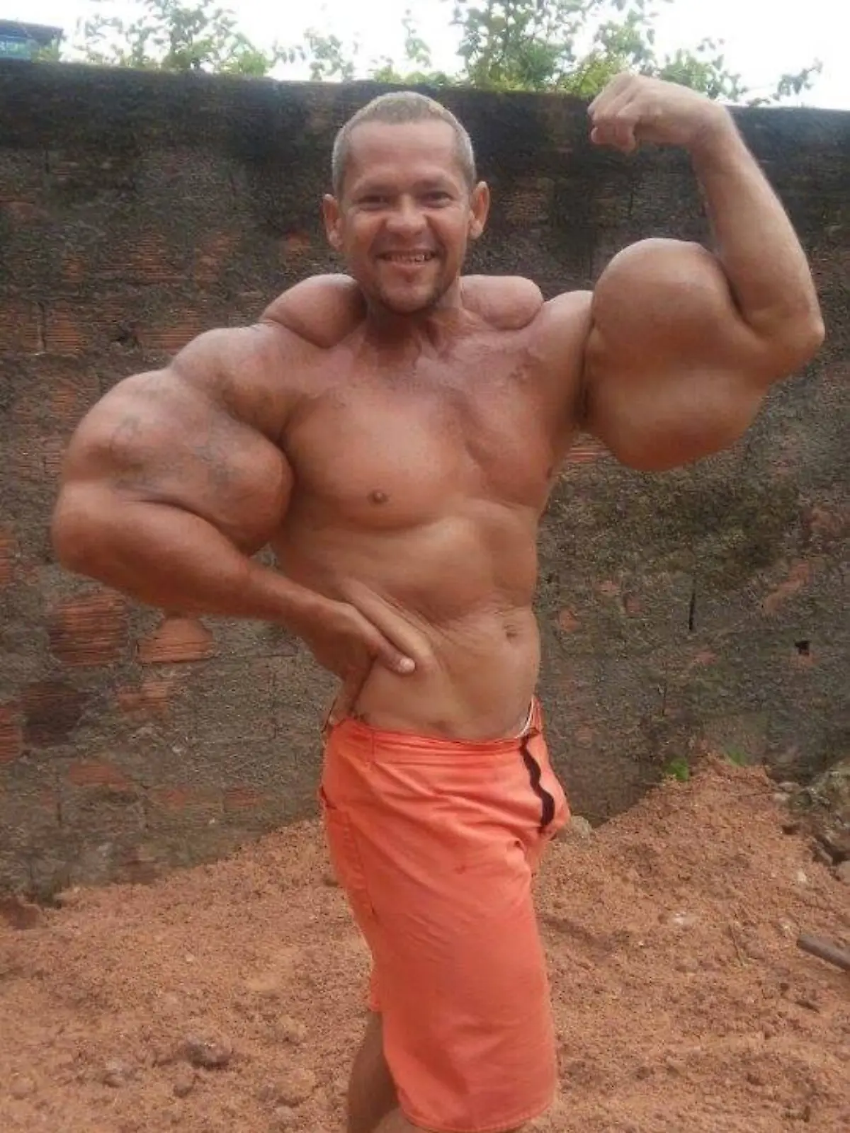 Bild zu: "Er hatte die größten Arme des Landes! Brasilianischer Popeye ist tot"