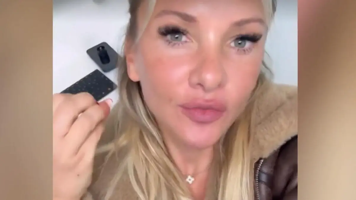 Ihre Hautärztin entdeckt ein auffälliges Muttermal: Das rät sie ihren Fans Krebs-Schock für Evelyn Burdecki!