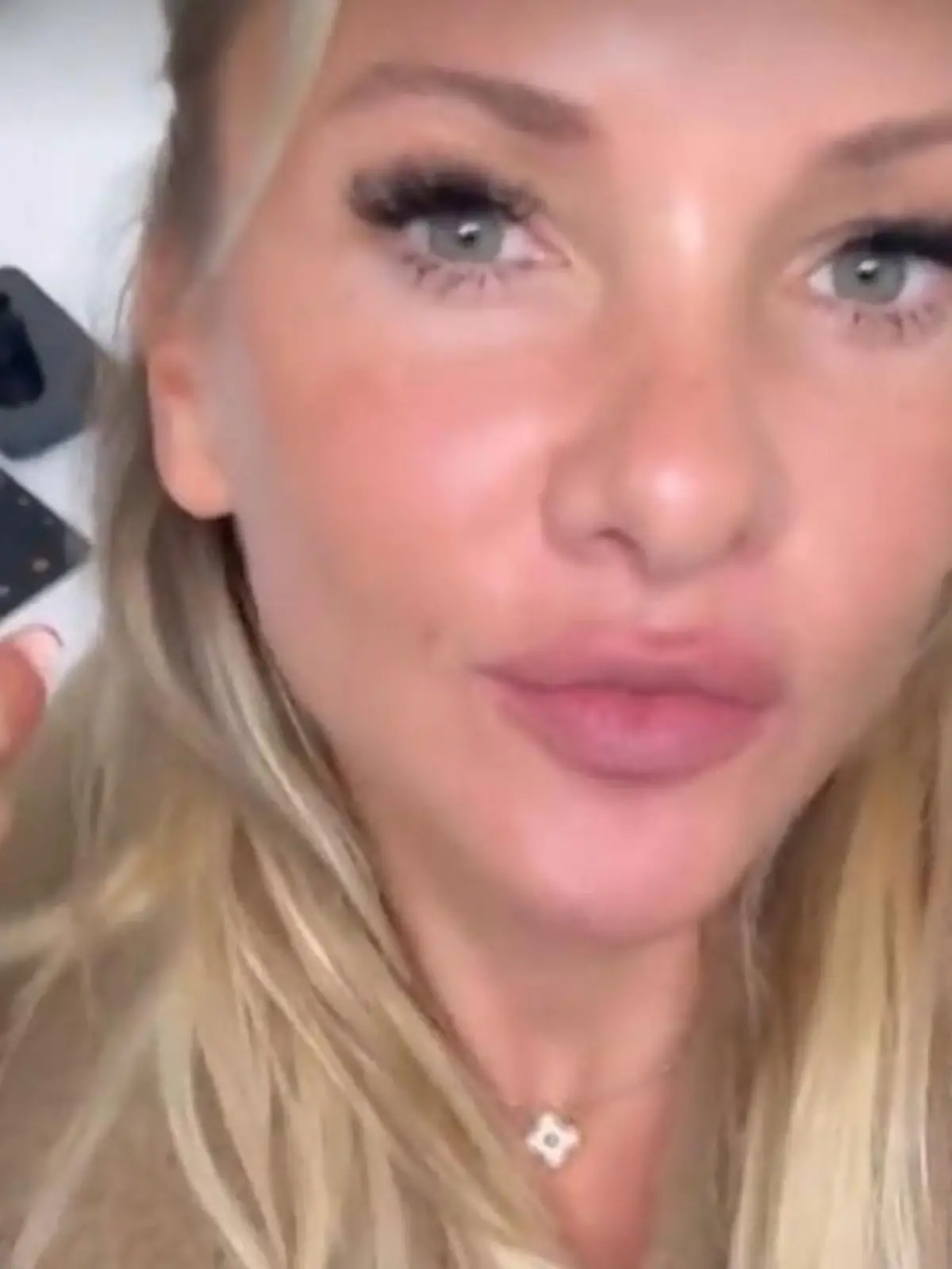 Bild zu: "Ihre Hautärztin entdeckt ein auffälliges Muttermal: Das rät sie ihren Fans"