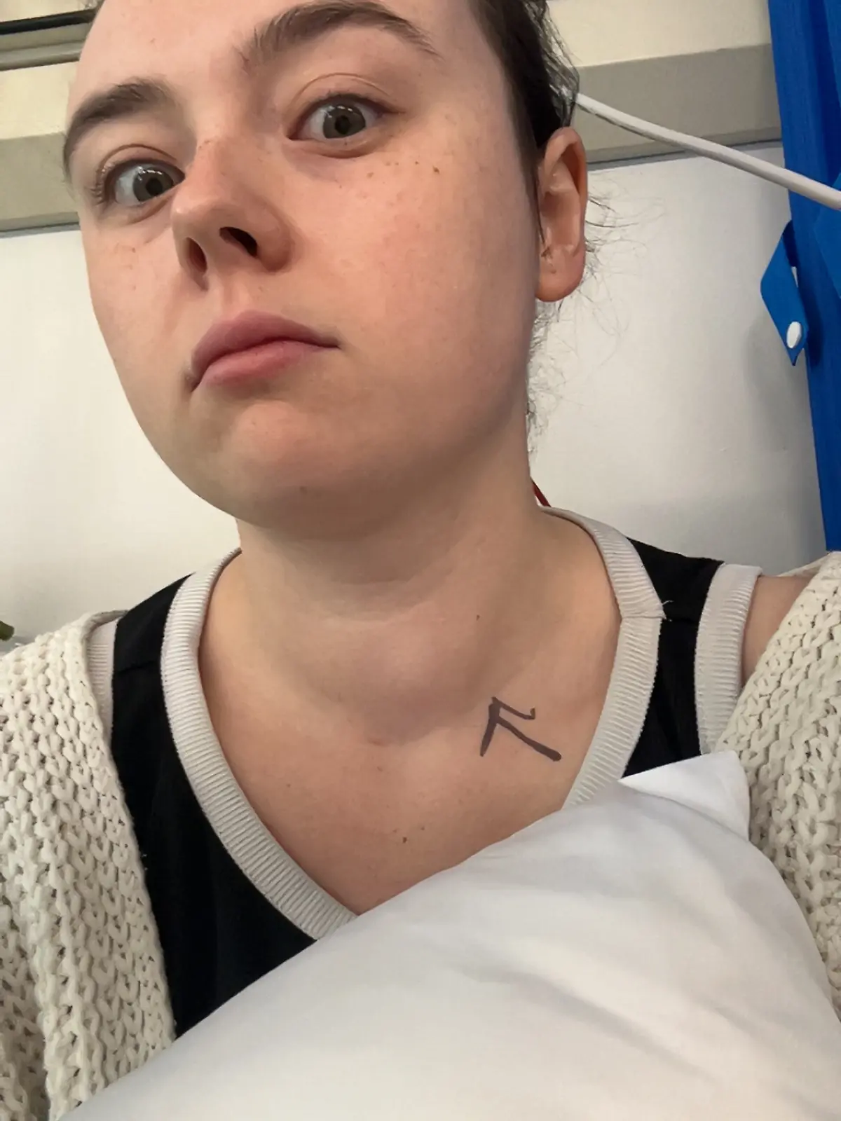 Bild zu: "Beim Feiern im Pub fällt Hannas Beule am Hals auf – es ist Schilddrüsenkrebs"