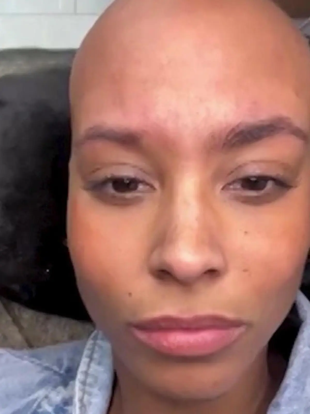 Bild zu: "Erst Haarausfall, jetzt DAS! Ex-„Let's Dance"-Star klagt über akuten Schub"