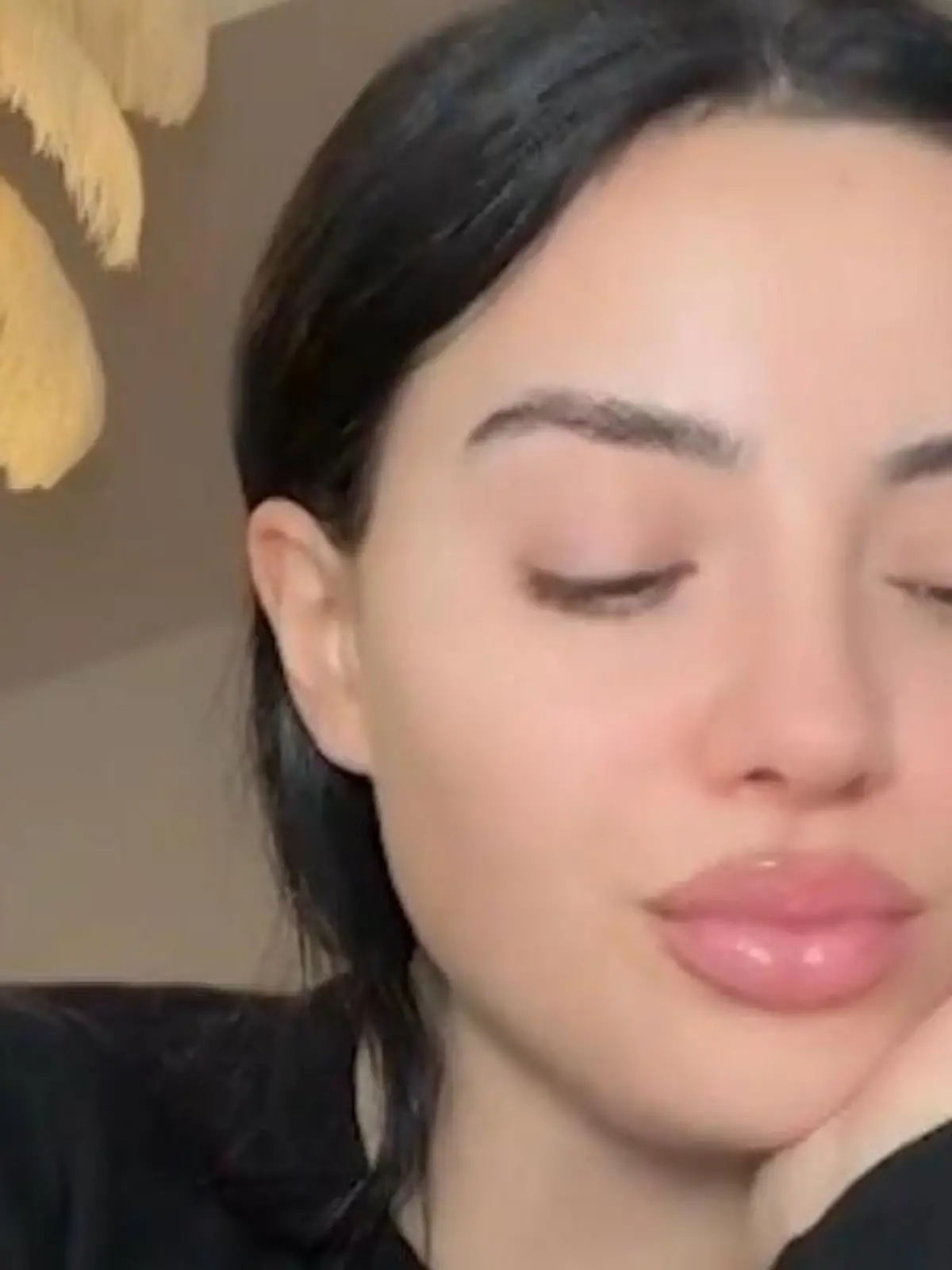 Bild zu: "Wegen Knubbel am Kopf! Leyla Heiter muss gleich zweimal operiert werden"