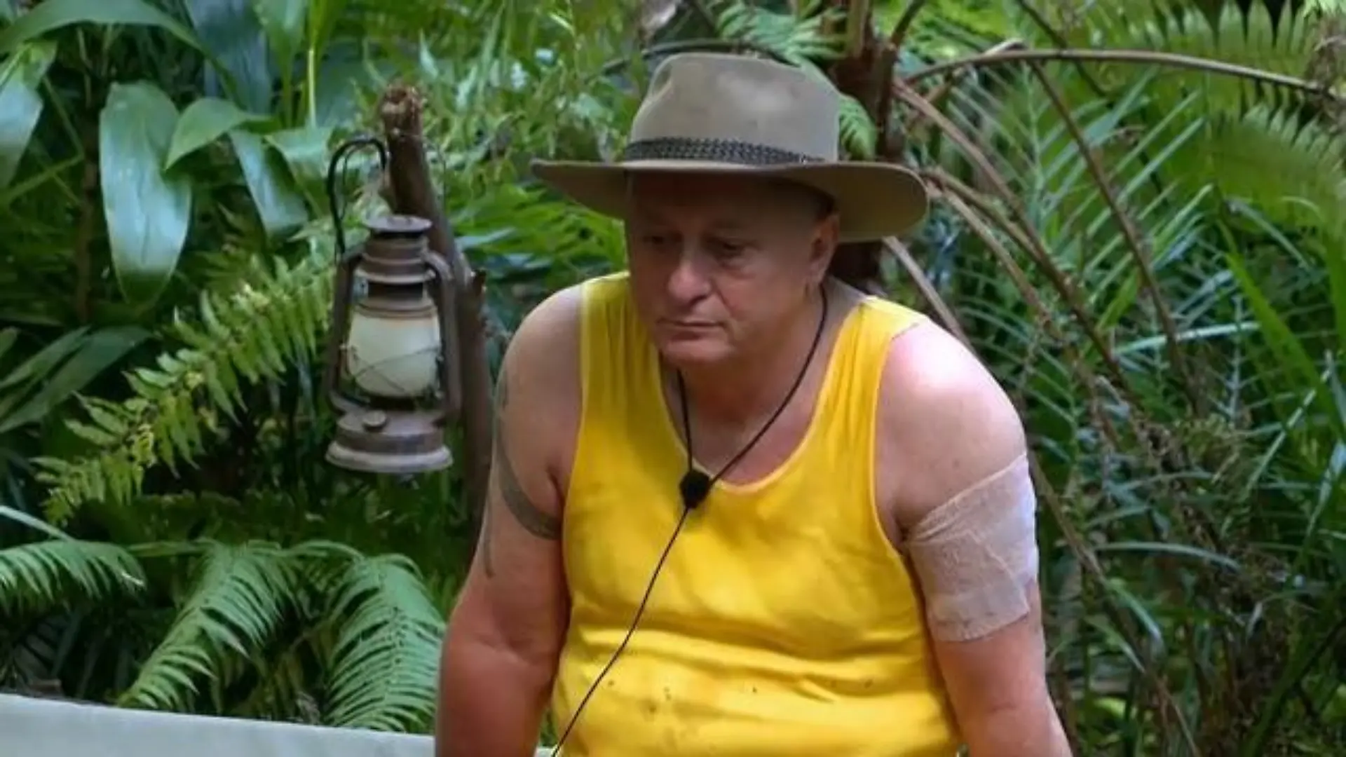 Hubert Fella zeigt sich an Tag 1 im Dschungelcamp mit Verband am Arm. 