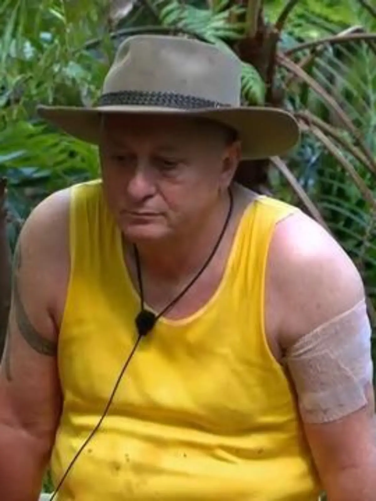 Hubert Fella zeigt sich an Tag 1 im Dschungelcamp mit Verband am Arm. 