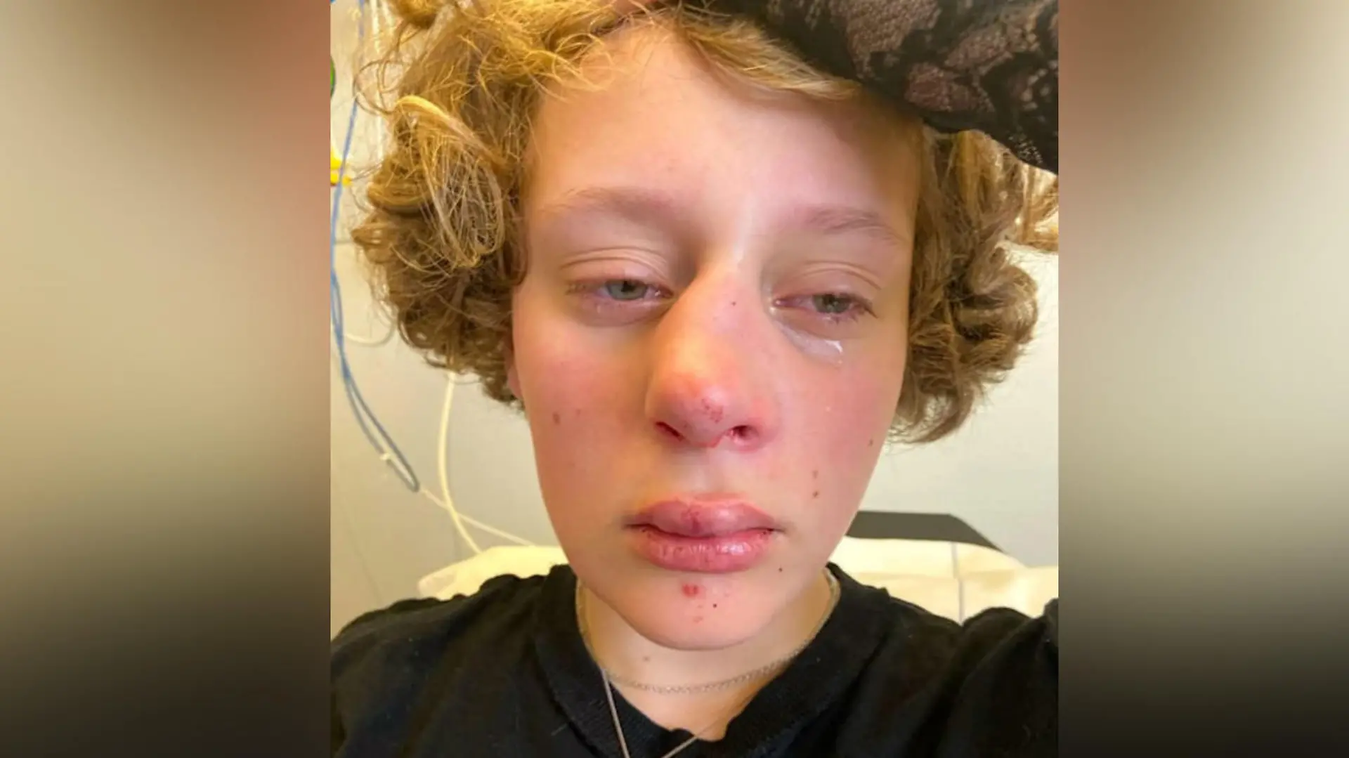 LGBTQ-Hassverbrechen? 14-Jährige in Amsterdam übelst verprügelt.