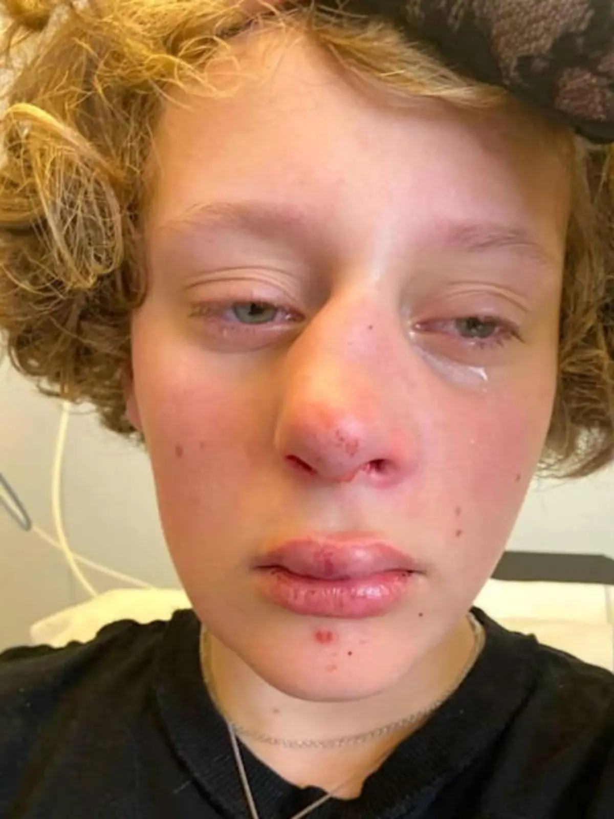 LGBTQ-Hassverbrechen? 14-Jährige in Amsterdam übelst verprügelt.